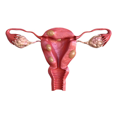 HORMONAL AND GYNECOLOGICAL DISORDERS